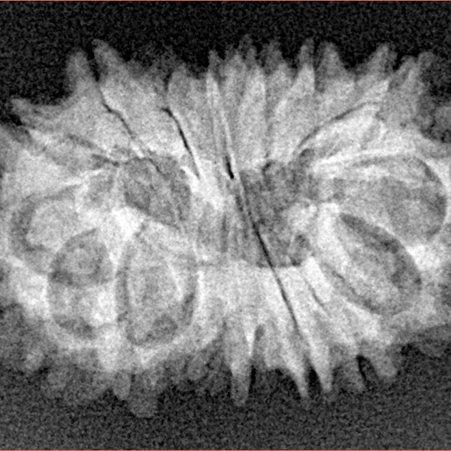 16 Mukhi Rudraksha 24.7mm 2.66gm - Xray