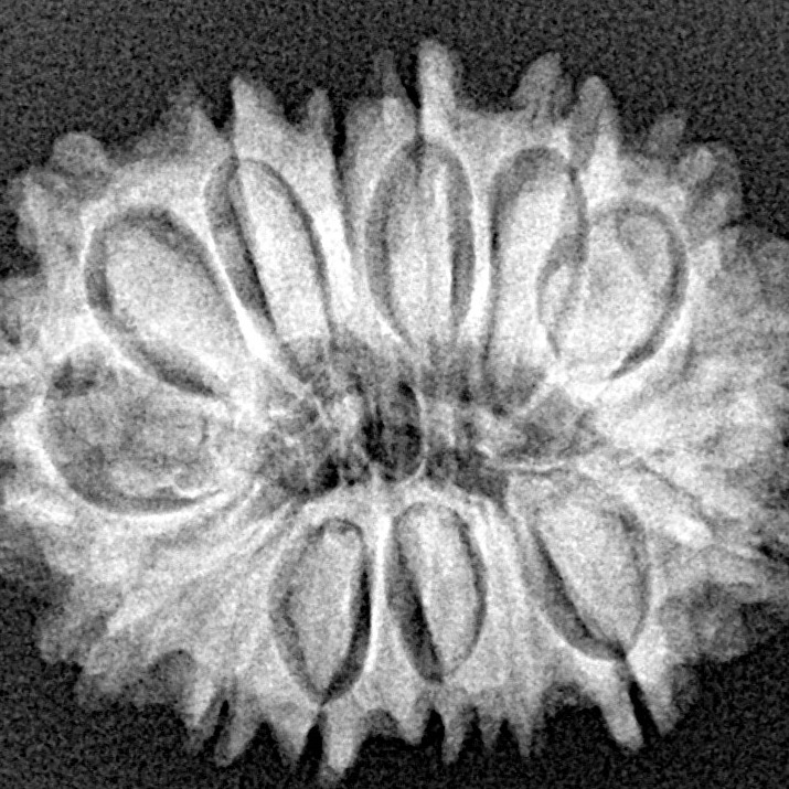 15 Mukhi Rudraksha 26.4mm 3.69gm - Xray