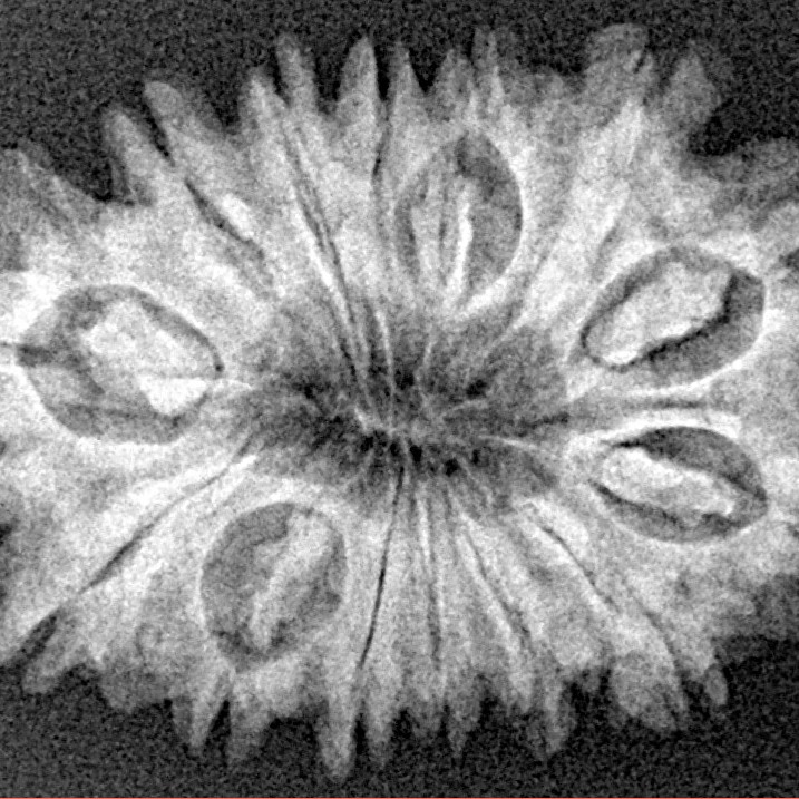 14 Mukhi Rudraksha 28.2mm 4gm - Xray