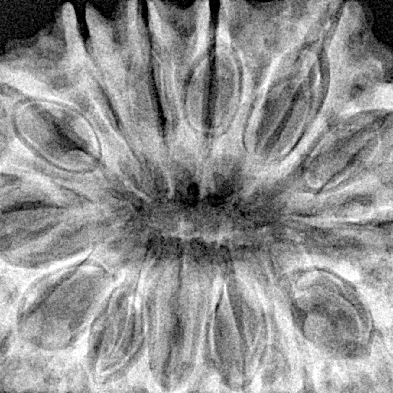 14 Mukhi Rudraksha 35.6mm 8gm - Xray