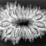 15 Mukhi Rudraksha 32.1mm 5.17gm - Xray