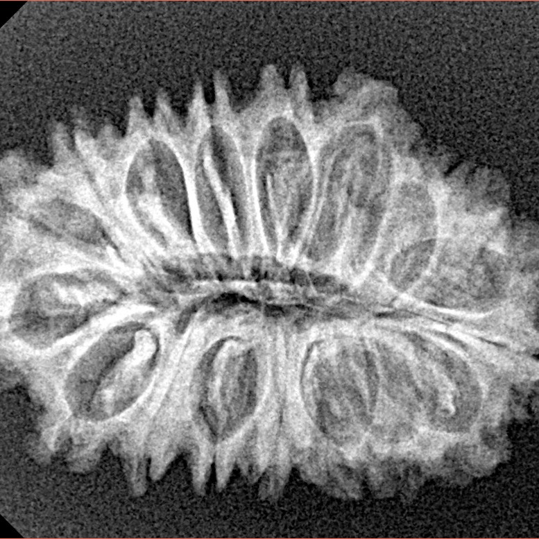 19 Mukhi Rudraksha 28.8mm 3.34gm - Xray