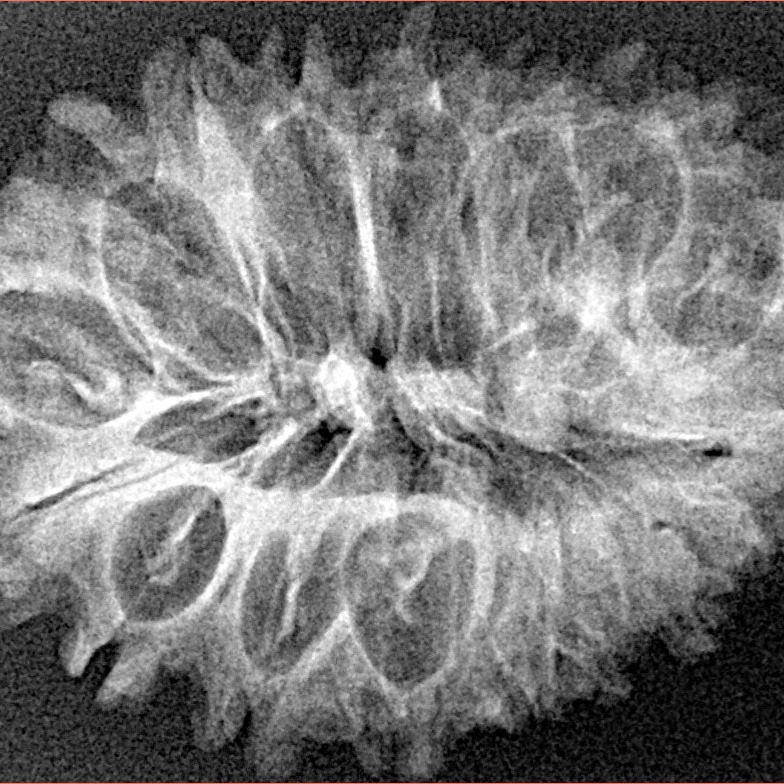 17 Mukhi Rudraksha 33mm 4gm - Xray