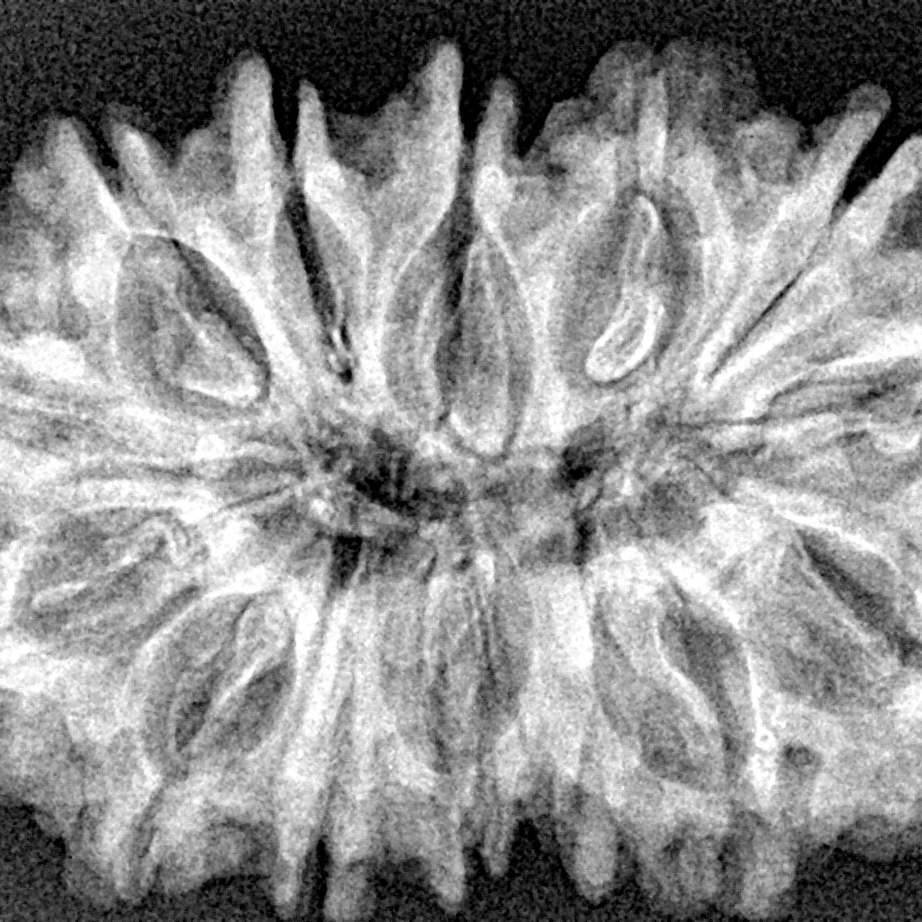 14 Mukhi Rudraksha 33.4mm 5.64gm - Xray
