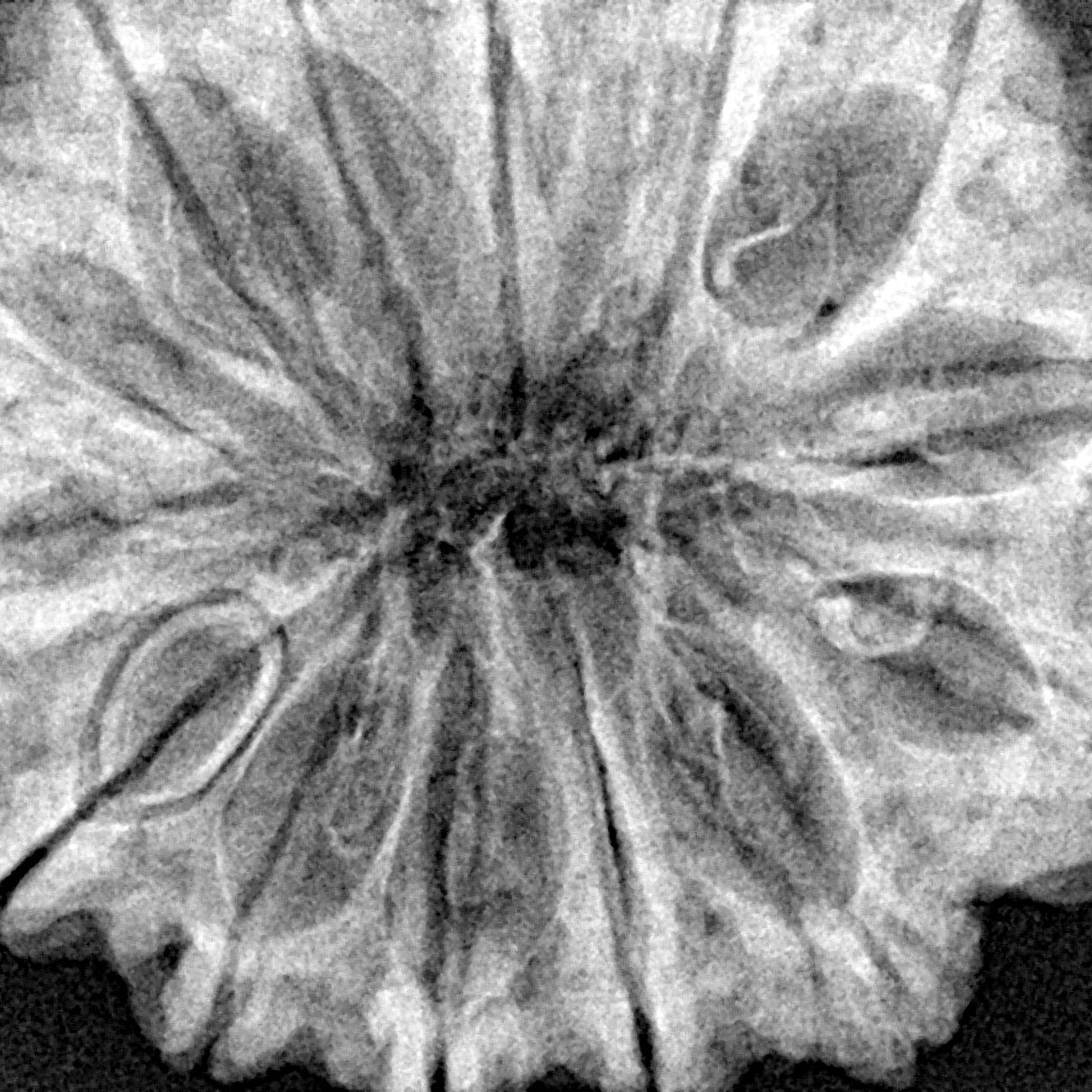 14 Mukhi Rudraksha 33.3mm 7.36gm - Xray