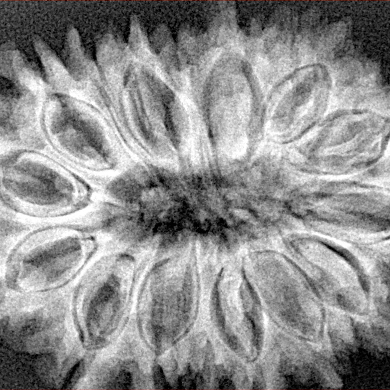 17 Mukhi Rudraksha 34.2mm 6.13gm - Xray