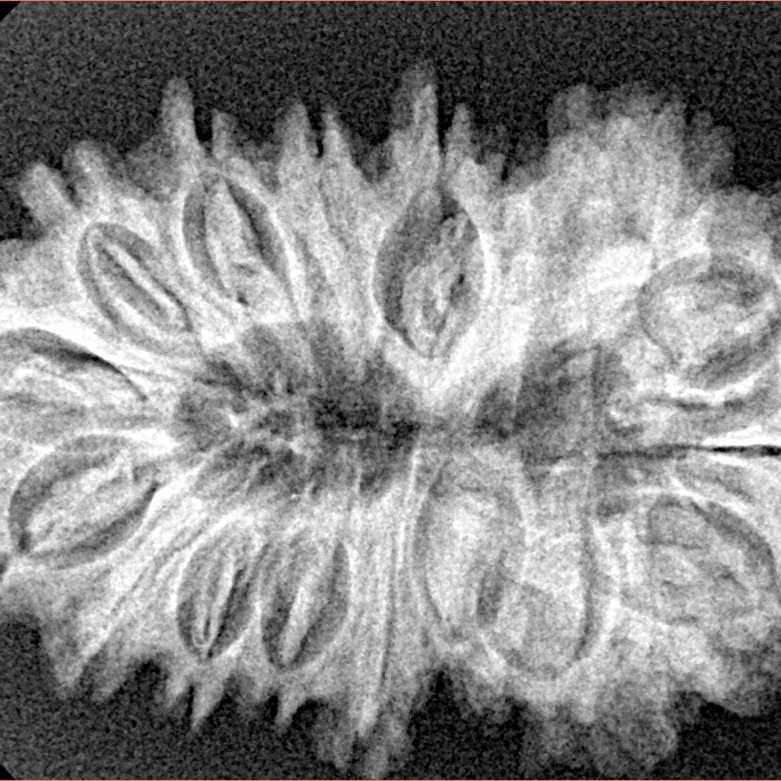 17 Mukhi Rudraksha 32.9mm 5.14gm - Xray