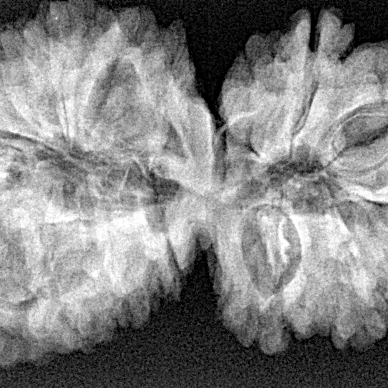 16 Mukhi Gaurishankar 39mm 7.4gm - Xray