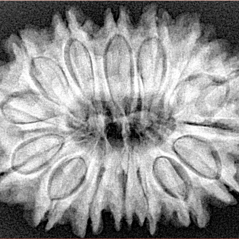 15 Mukhi Rudraksha 32.1mm 6.6gm - Xray