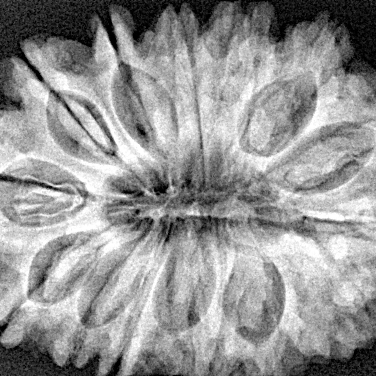 15 Mukhi Rudraksha 33.6mm 7.34gm - Xray