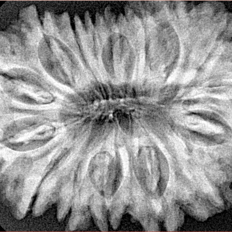 16 Mukhi Rudraksha 34.9mm 7.4gm - Xray