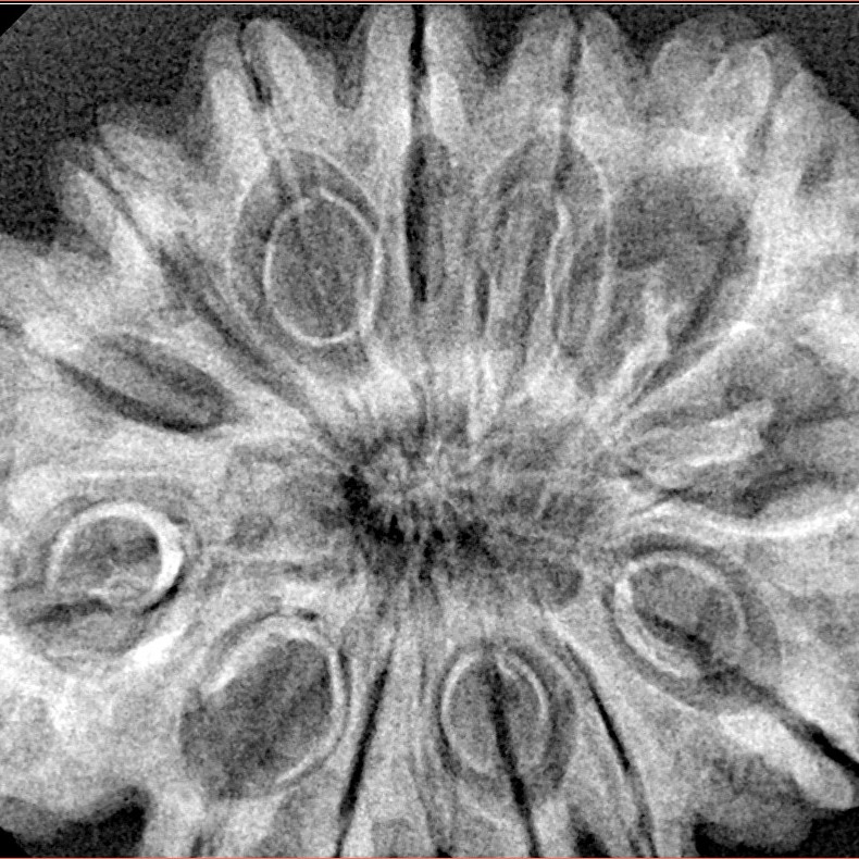 14 Mukhi Rudraksha 34mm 6.49gm - Xray