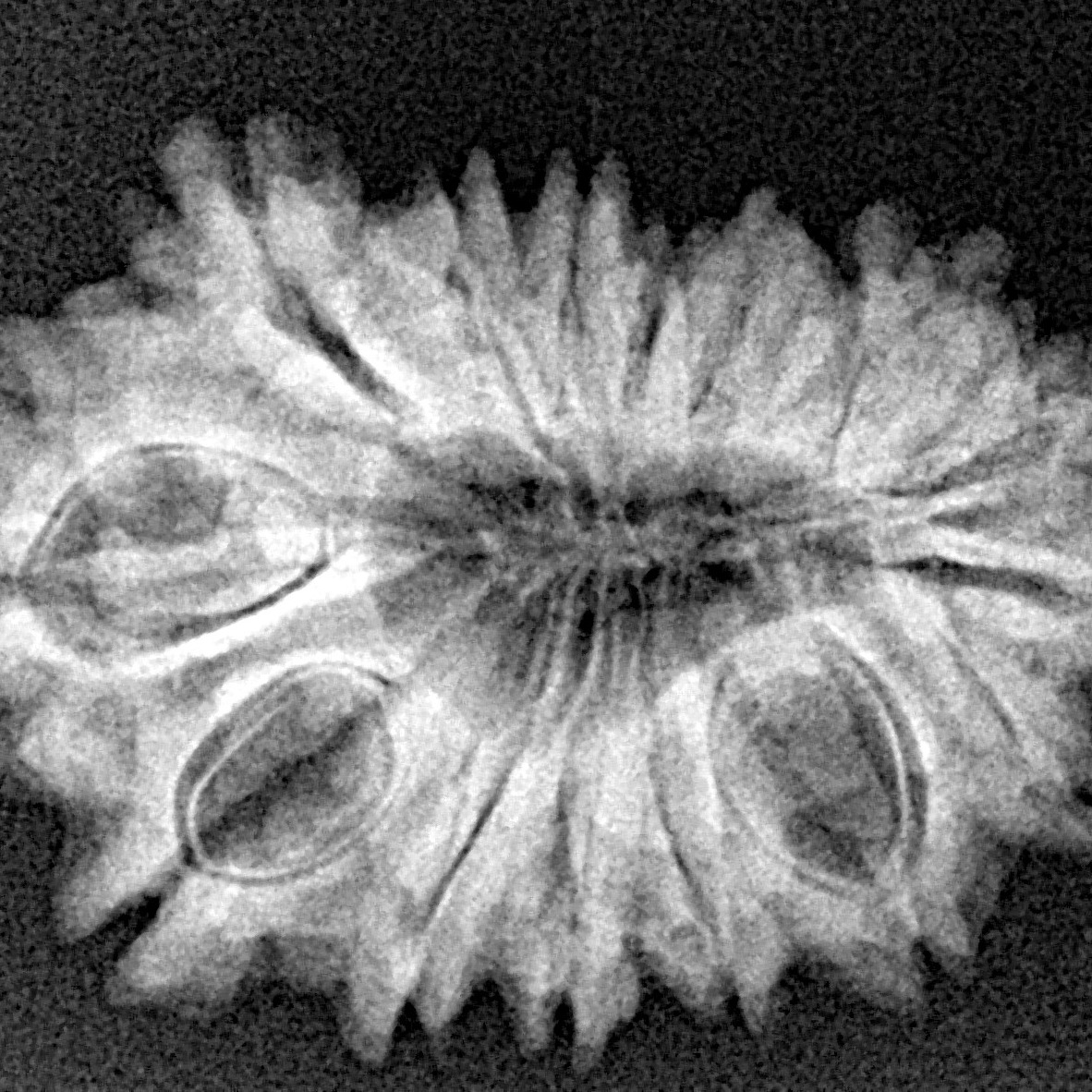 16 Mukhi Rudraksha 27.8mm 3.66gm - Xray