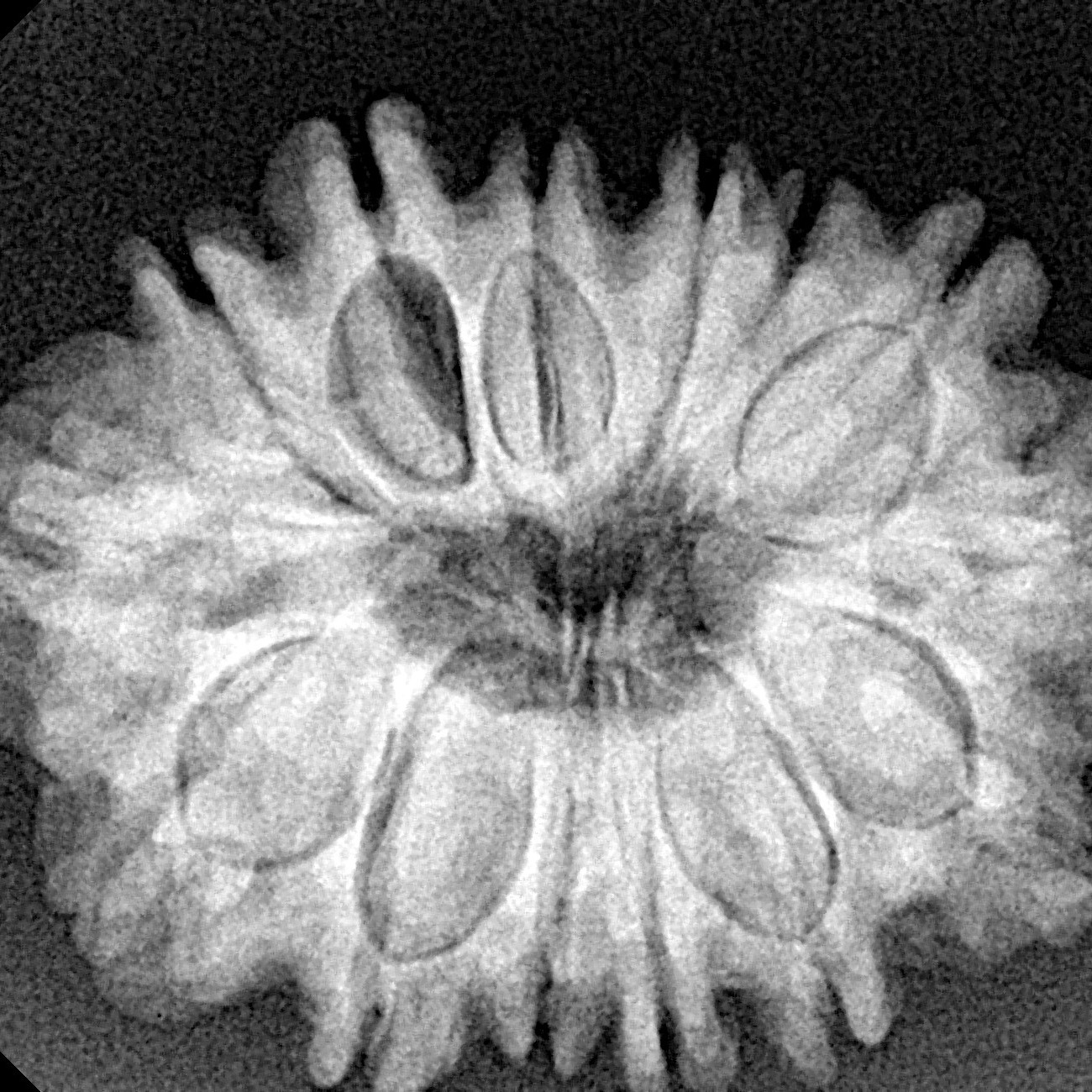 14 Mukhi Rudraksha 28.1mm 5.32gm - Xray