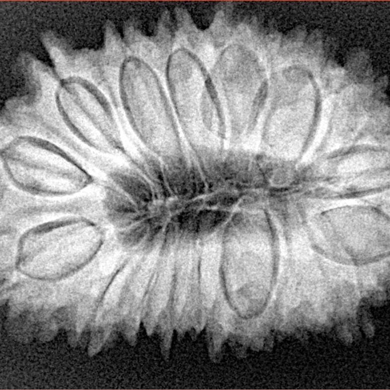 17 Mukhi Rudraksha 32.4mm 5.94gm - Xray