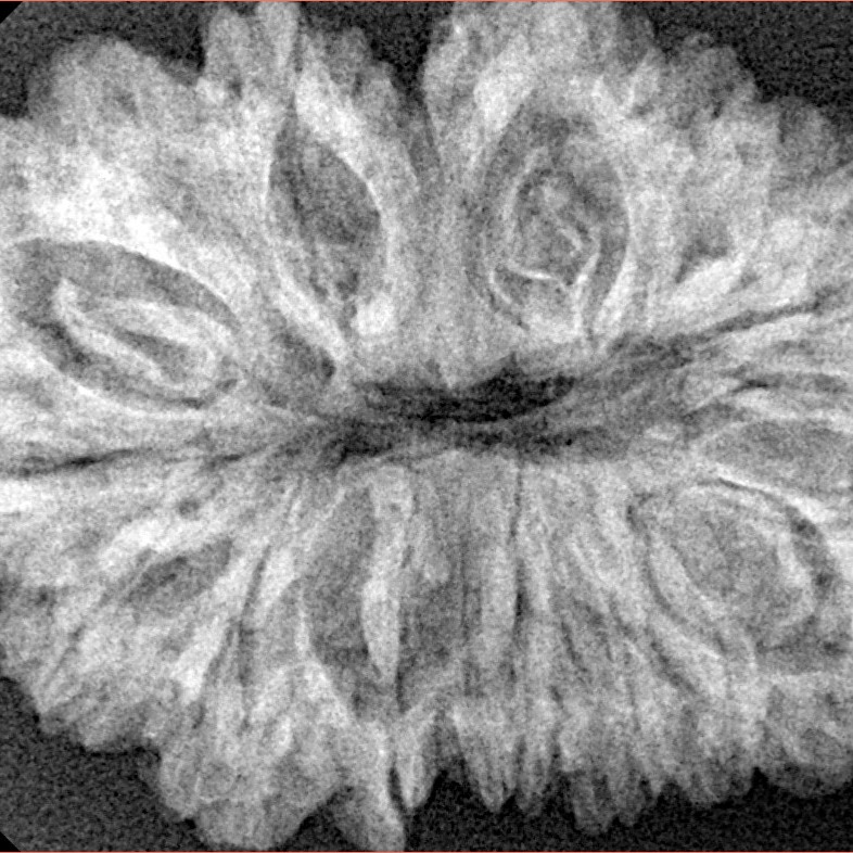 16 Mukhi Rudraksha 34.4mm 6.51gm - Xray