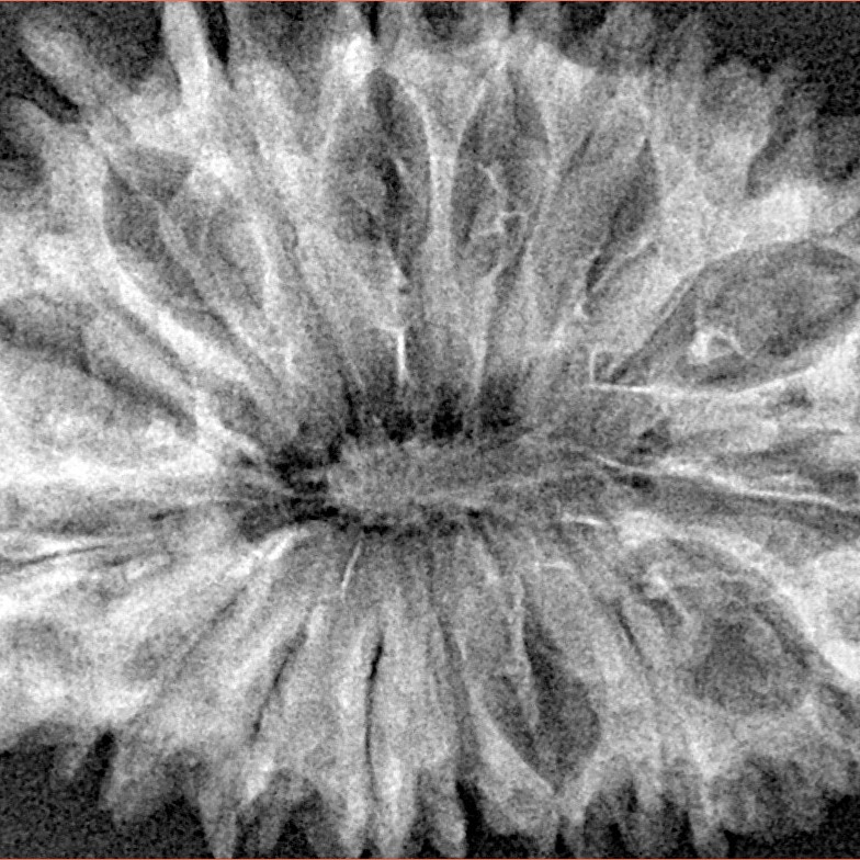 17 Mukhi Rudraksha 37.4mm 5.9gm - Xray