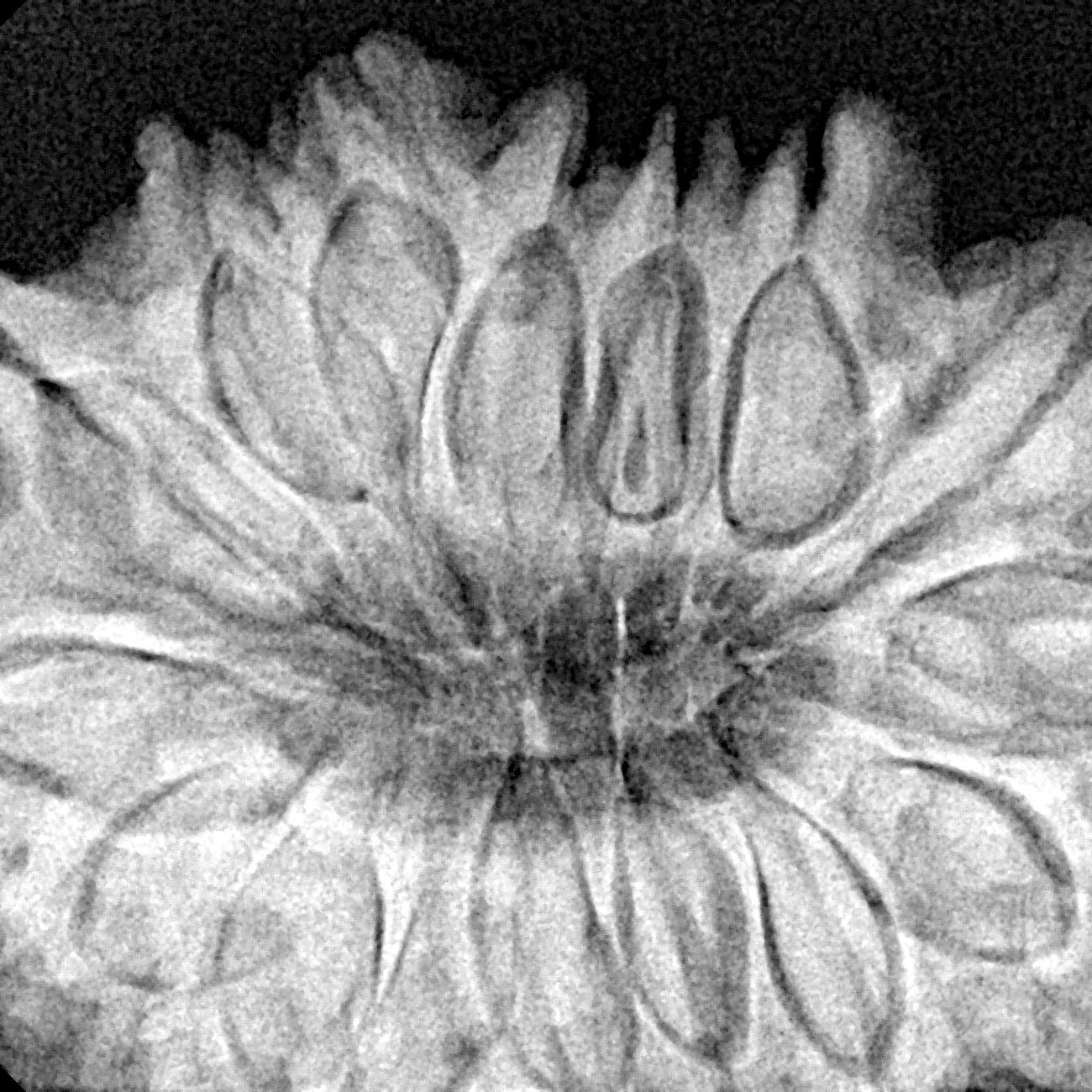 16 Mukhi Rudraksha 35mm 7.89gm - Xray