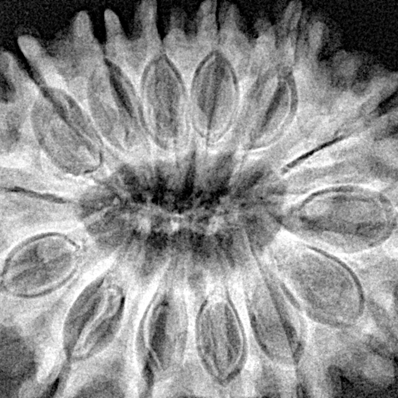 14 Mukhi Rudraksha 34.3mm 7.14gm - Xray