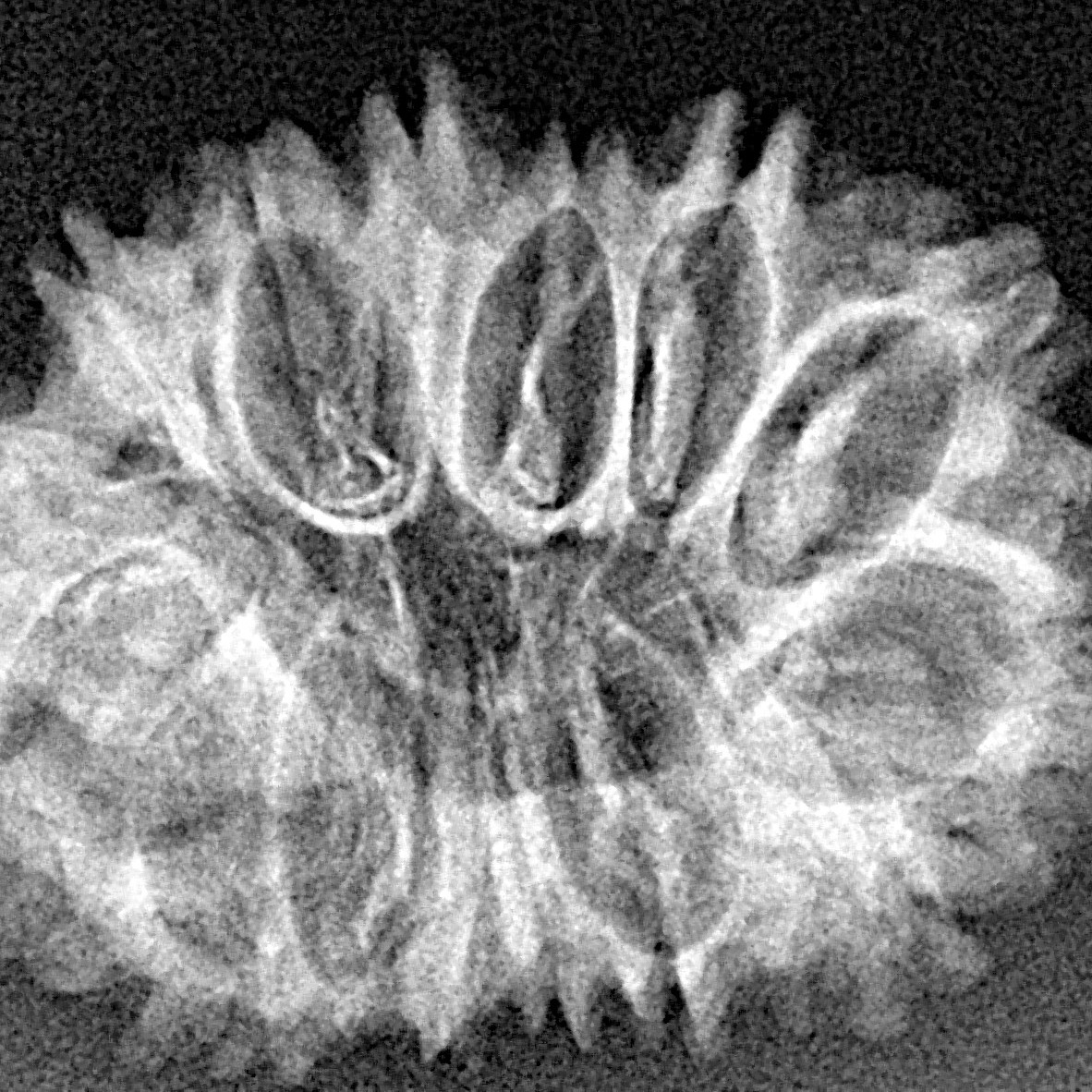 15 Mukhi Rudraksha 27.5mm 3.27gm - Xray