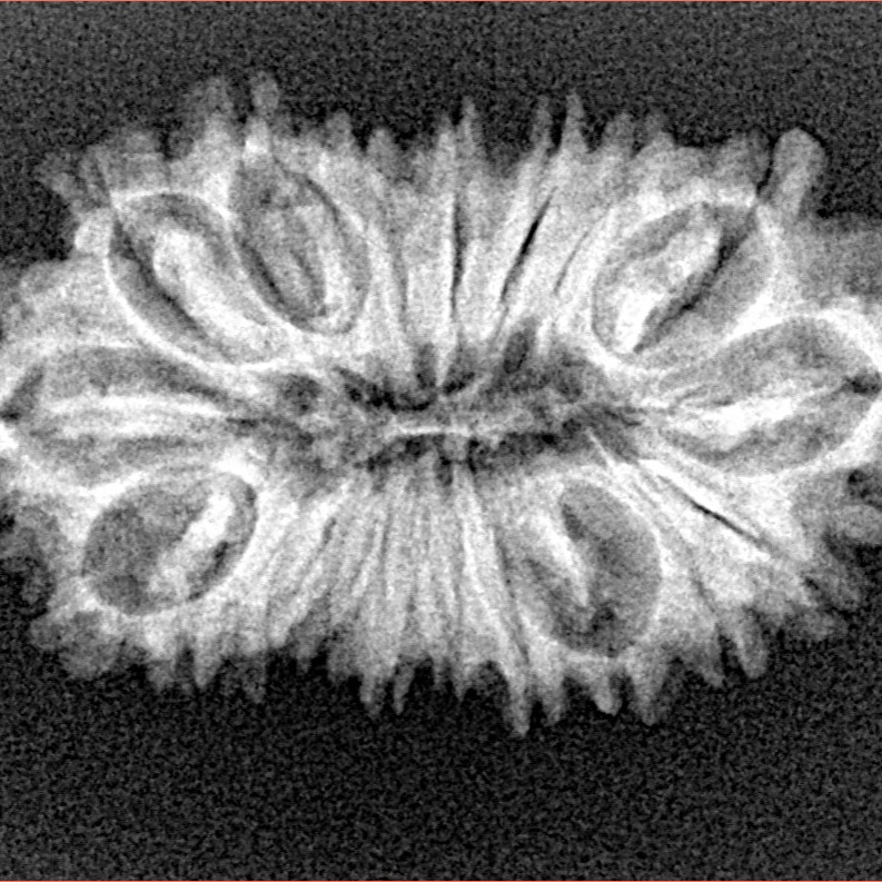 19 Mukhi Rudraksha 29.5mm 3.07gm - Xray