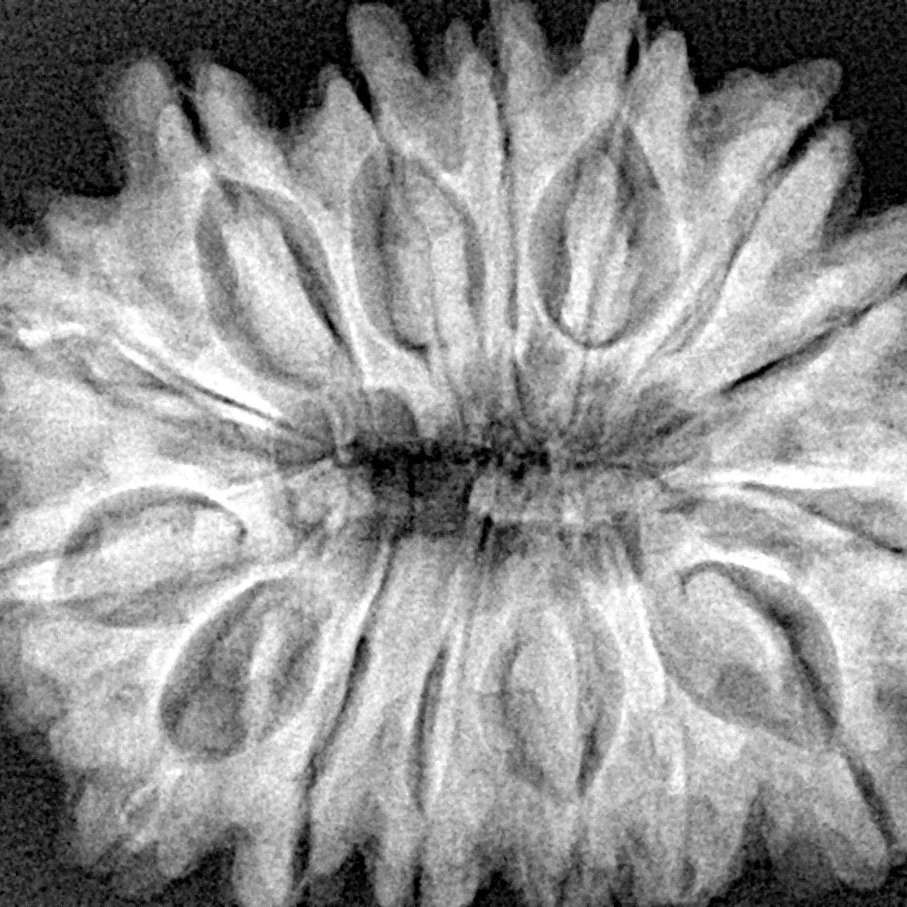 15 Mukhi Rudraksha 32.2mm 6.93gm - Xray