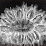 16 Mukhi Rudraksha 32.2mm 4.89gm - Xray