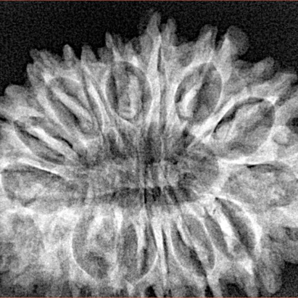 16 Mukhi Rudraksha 32.2mm 4.89gm - Xray