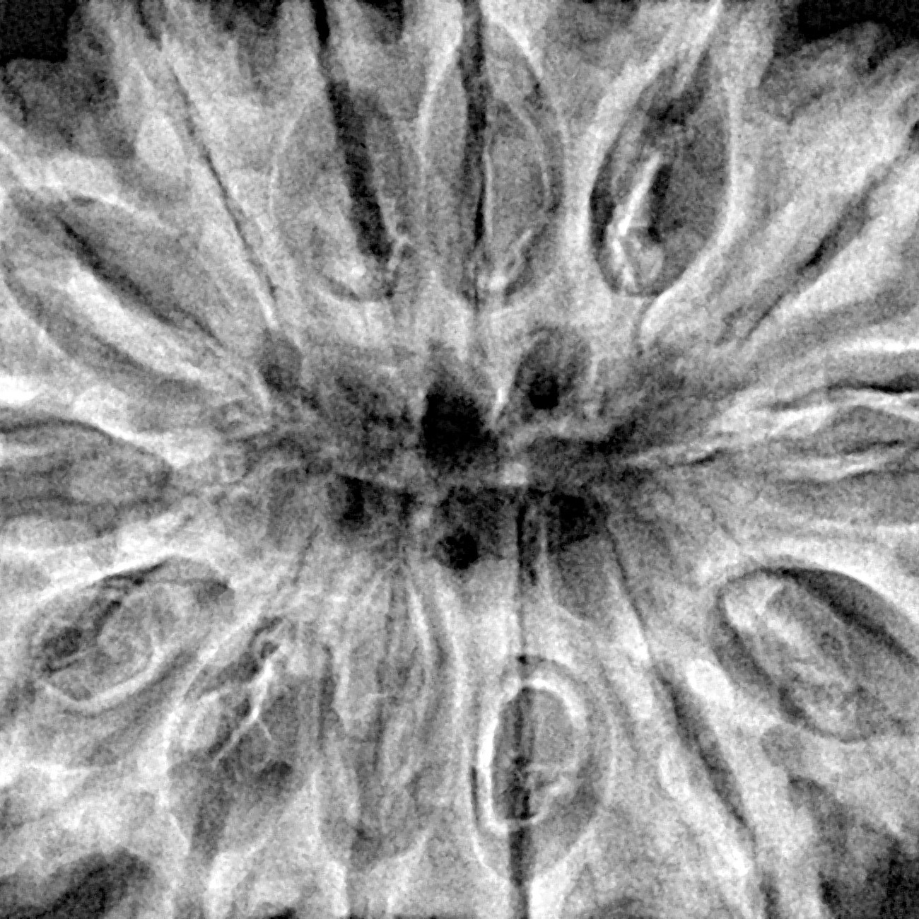 14 Mukhi Rudraksha 39mm 9.21gm - Xray