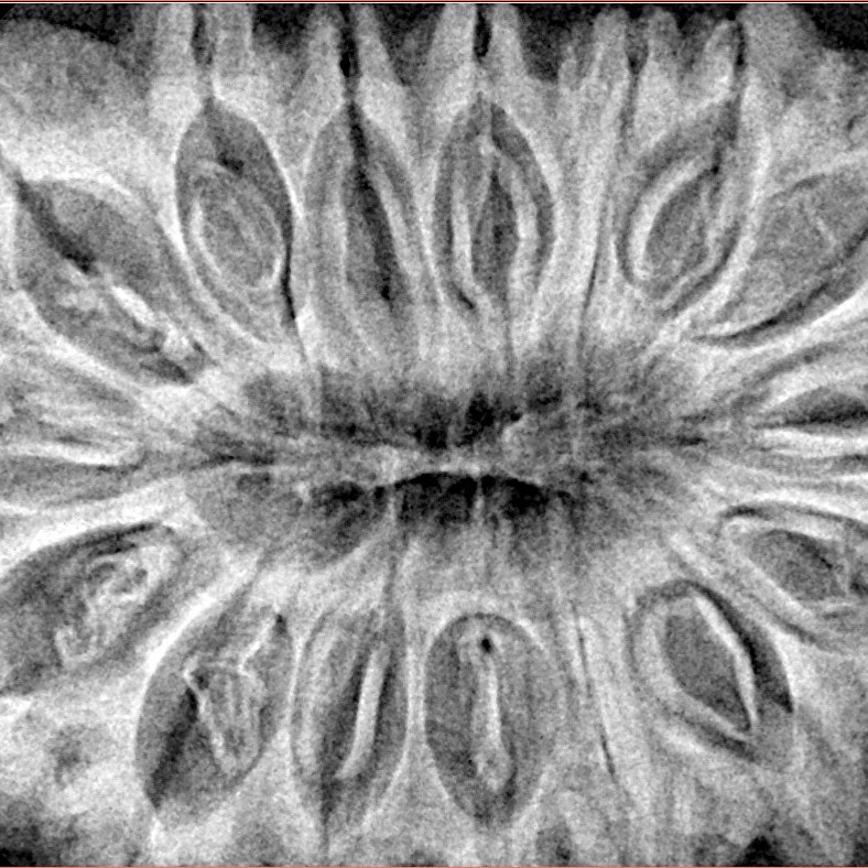 16 Mukhi Rudraksha 39.3mm 9.49gm - Xray