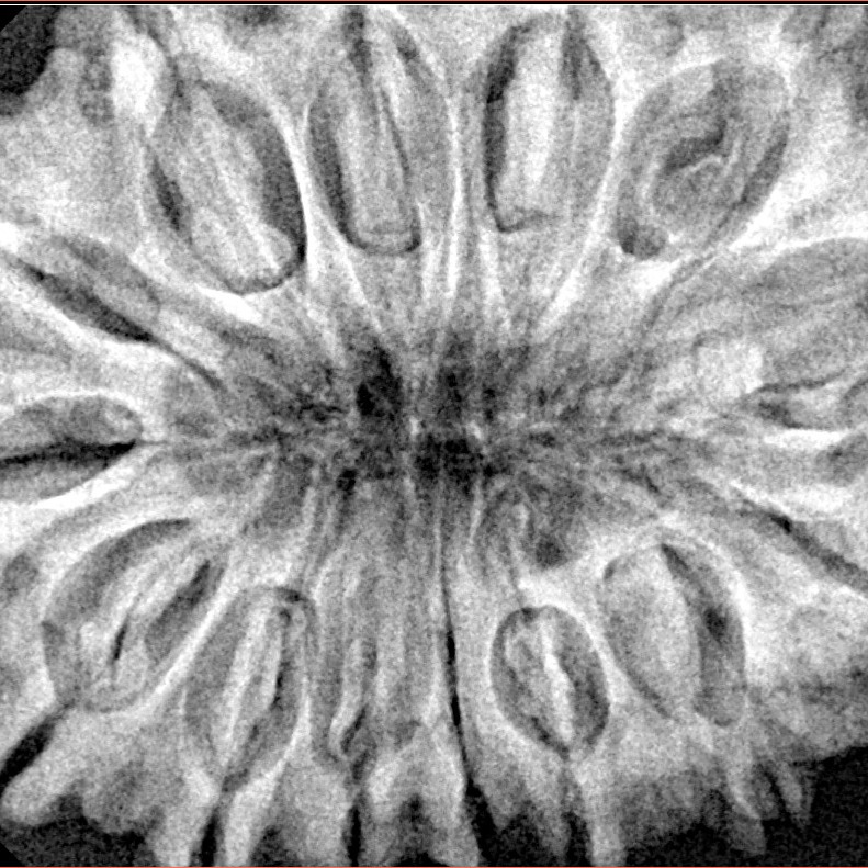 14 Mukhi Rudraksha 36.7mm 8.51gm - Xray