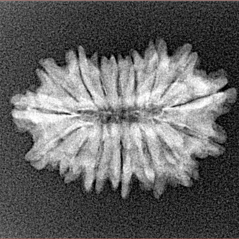 16 Mukhi Rudraksha 24mm 2.07gm - Xray
