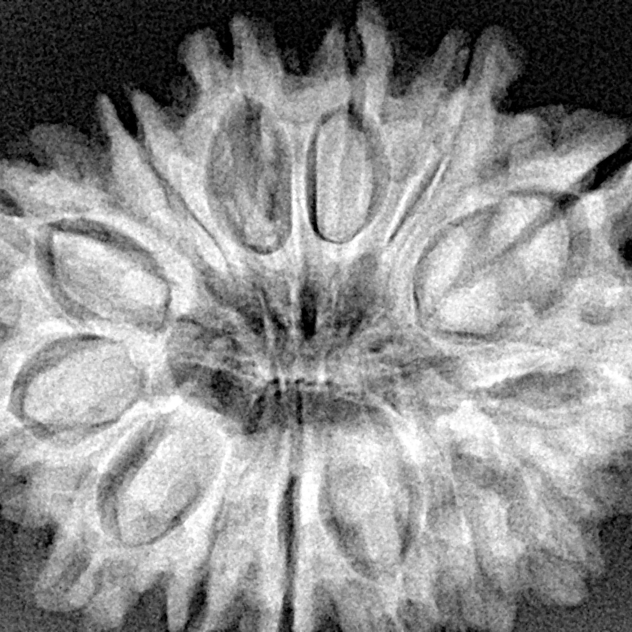 14 Mukhi Rudraksha 32.3mm 6.3gm - Xray