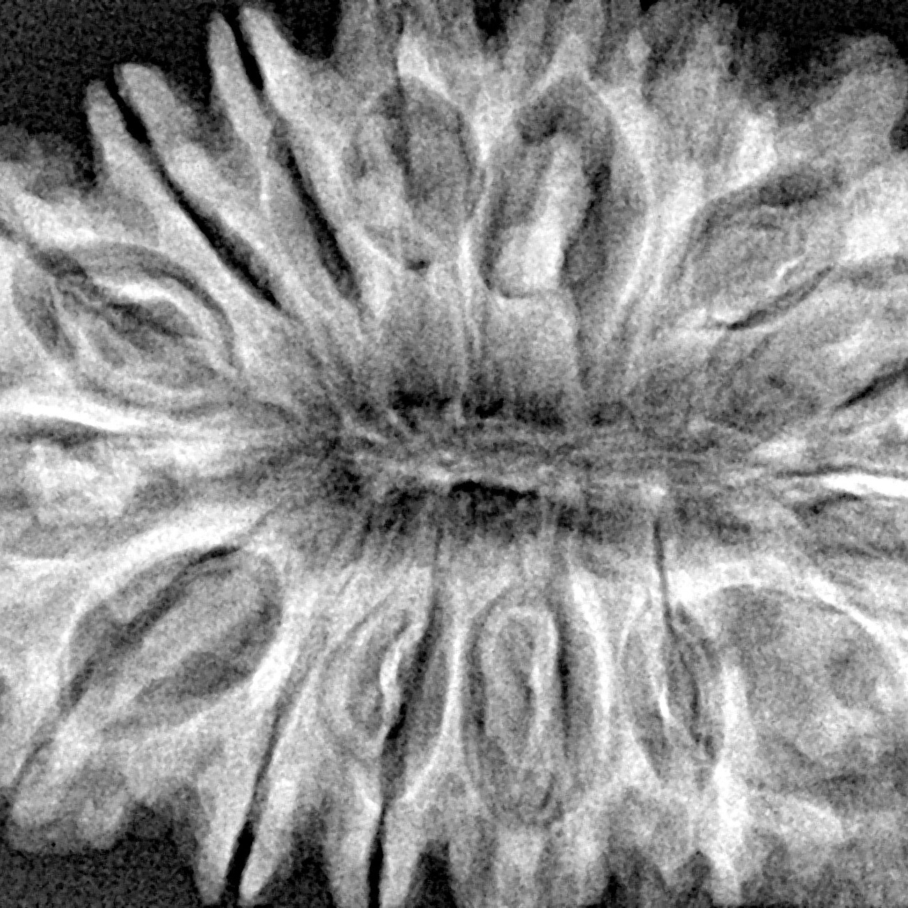 16 Mukhi Rudraksha 37.6mm 7.52gm - Xray