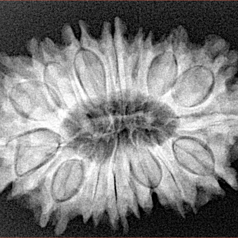 17 Mukhi Rudraksha 30.6mm 5.55gm - Origin: Nepal - Xray