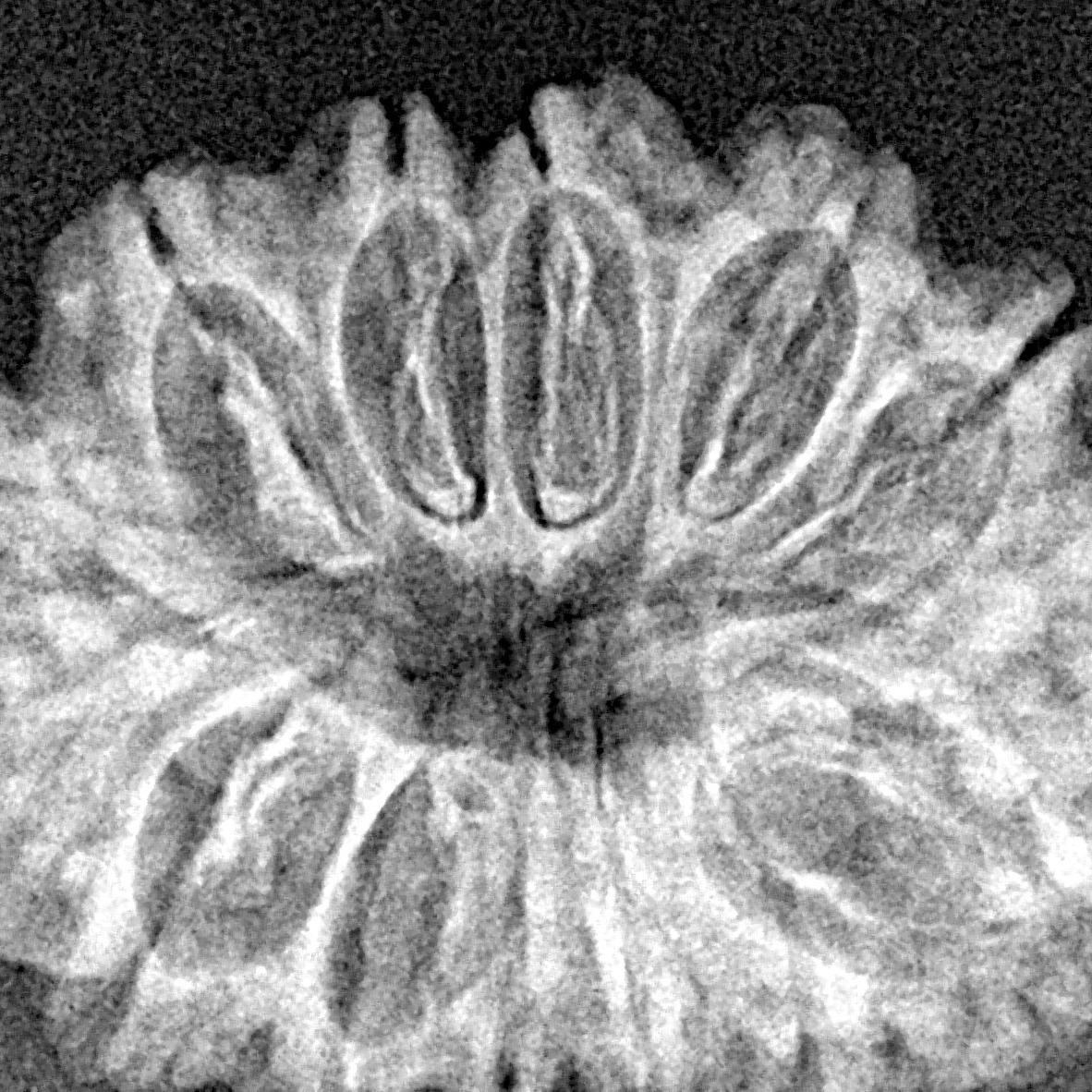 14 Mukhi Rudraksha 28.9mm 3.81gm - Xray