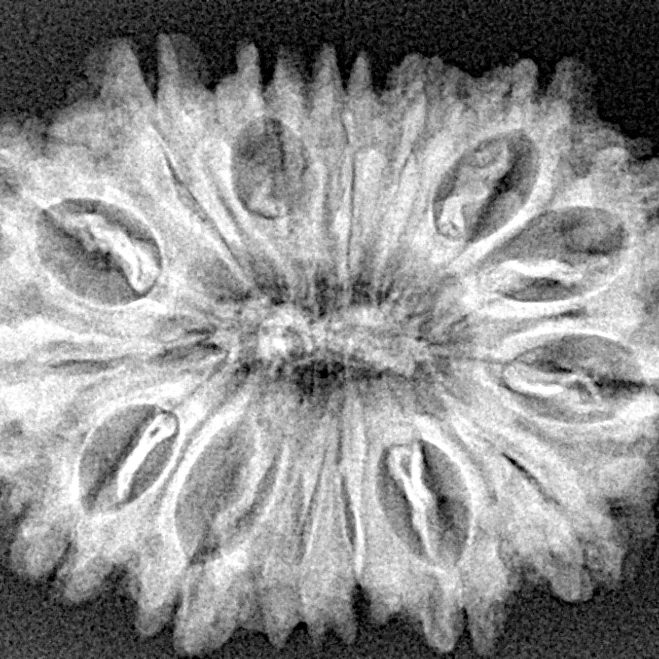 15 Mukhi Rudraksha 31mm 5.19gm - Xray