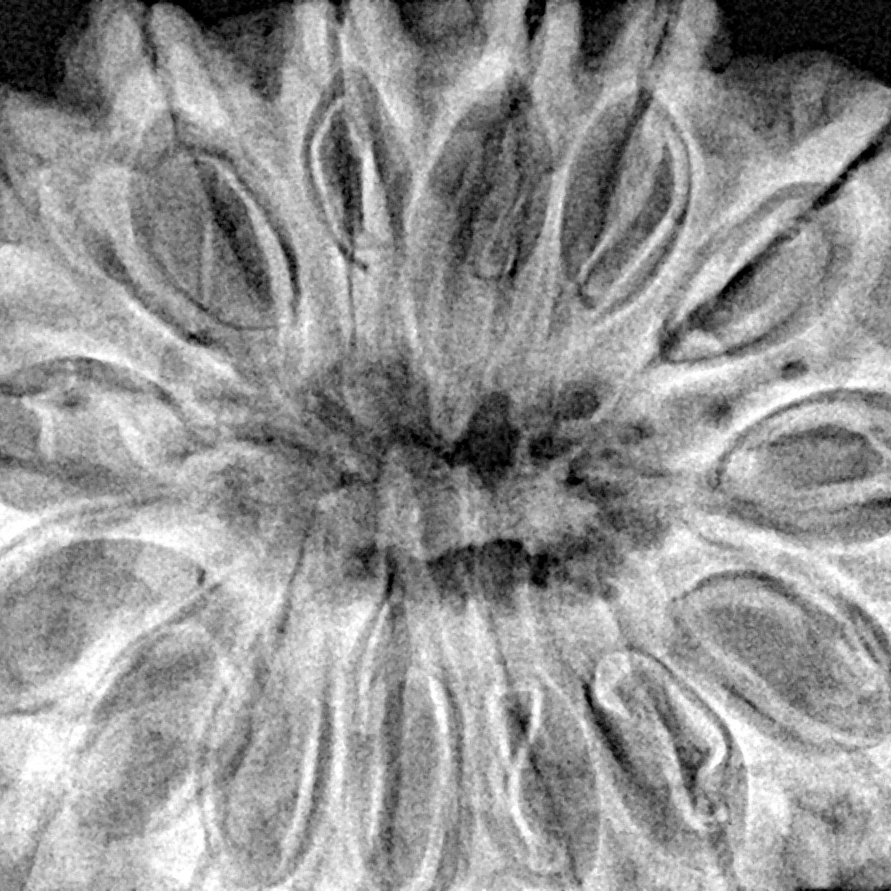 15 Mukhi Rudraksha 37.5mm 10gm - Xray