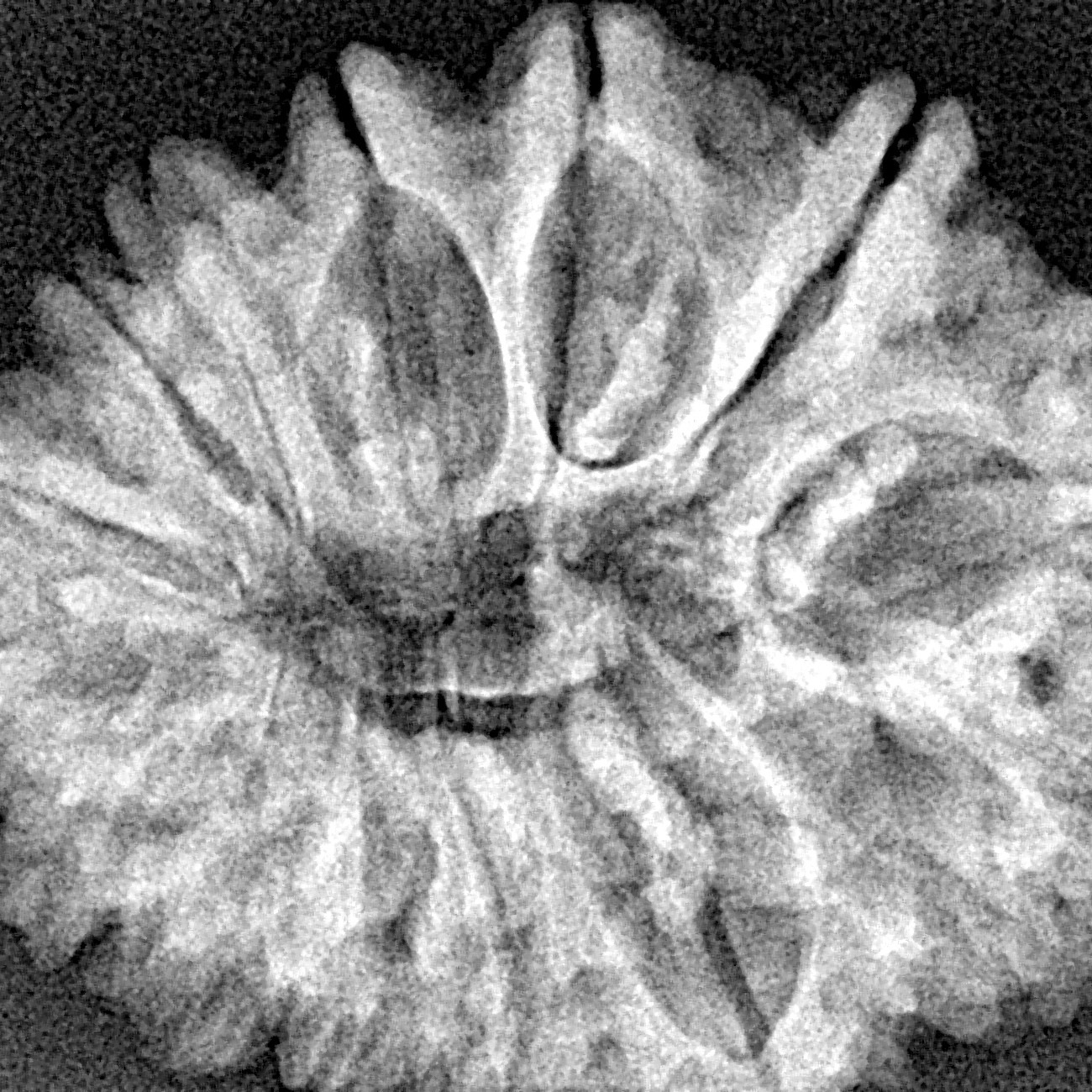 14 Mukhi Rudraksha 30.4mm 5.14gm - Xray