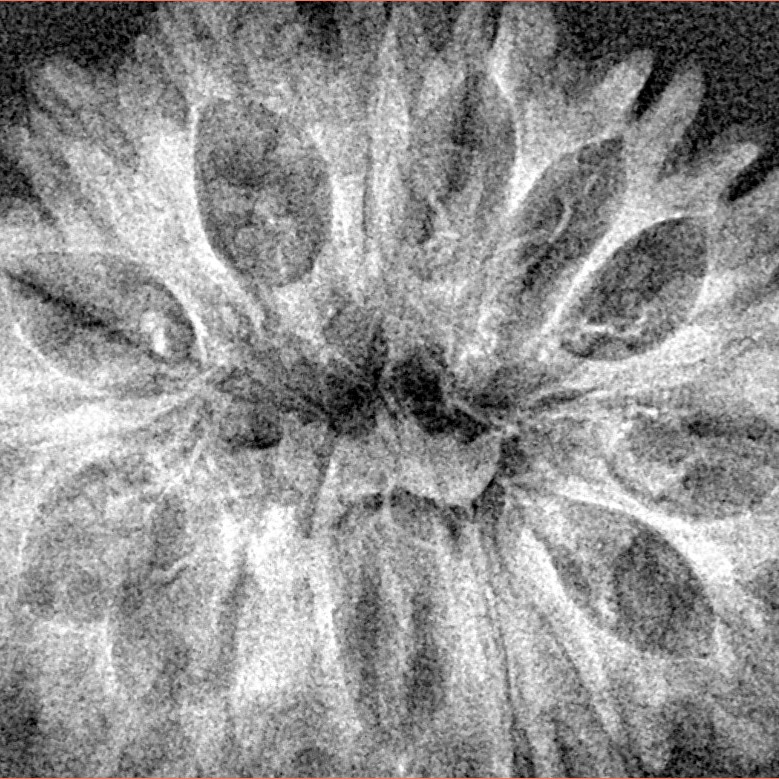 17 Mukhi Rudraksha 33.4mm 3.79gm - Xray