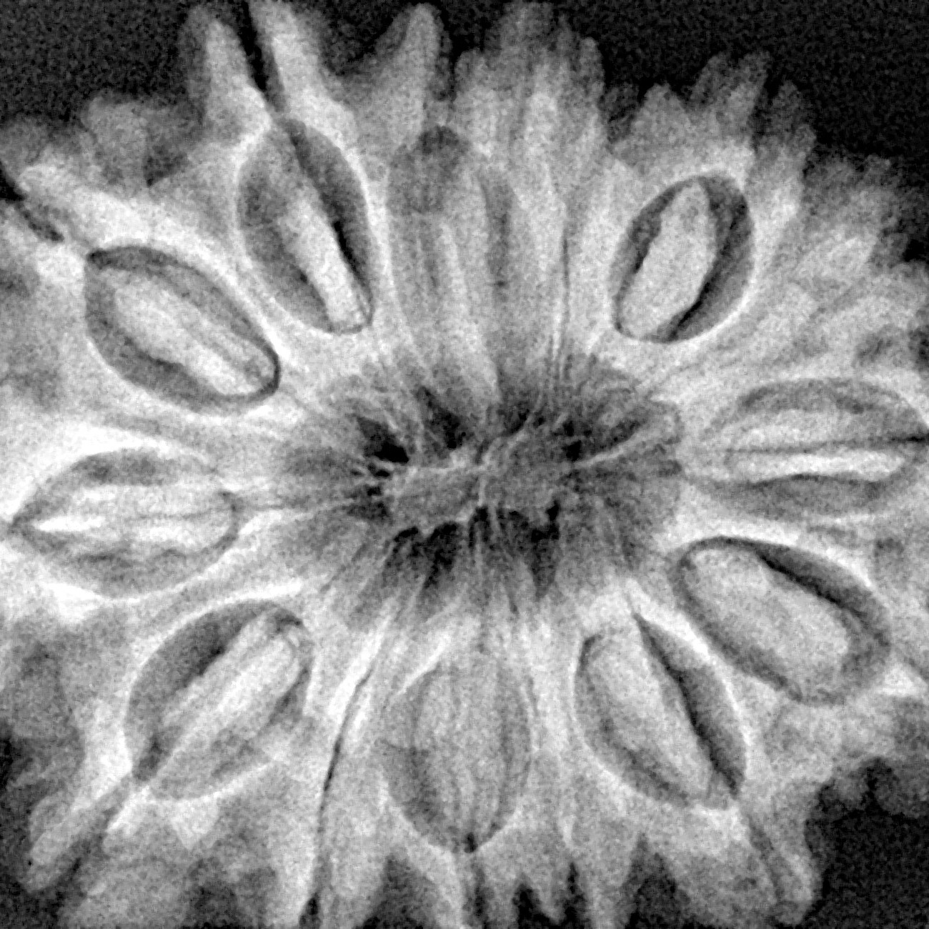 15 Mukhi Rudraksha 32.2mm 7gm - Xray