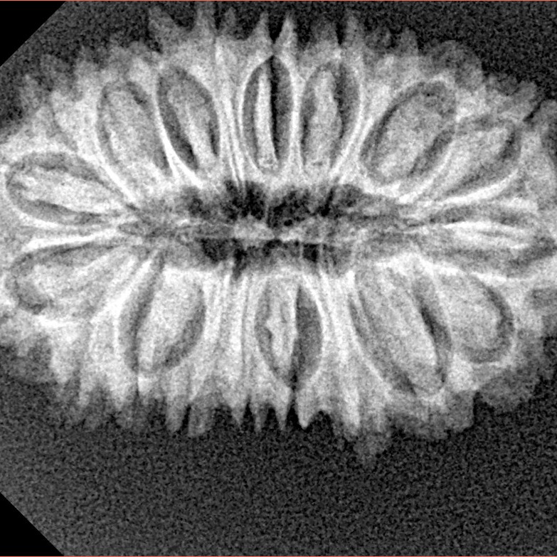 20 Mukhi Rudraksha 29.7mm 3.84gm - Xray