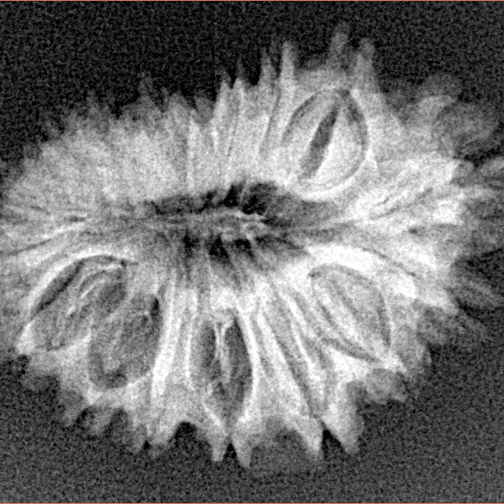 18 Mukhi Rudraksha 25.7mm 3.15gm - Xray