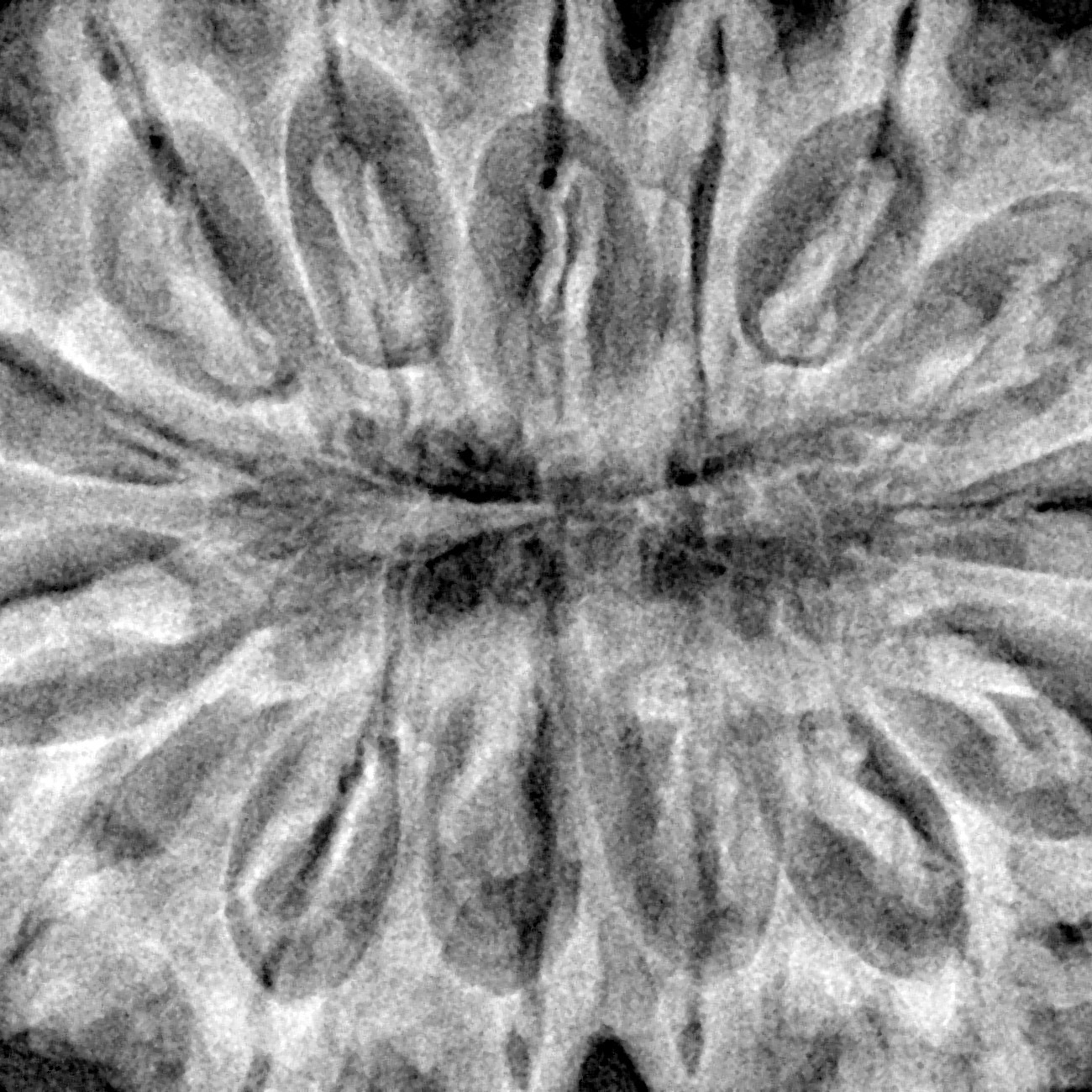 15 Mukhi Rudraksha 40mm 9.47gm - Xray