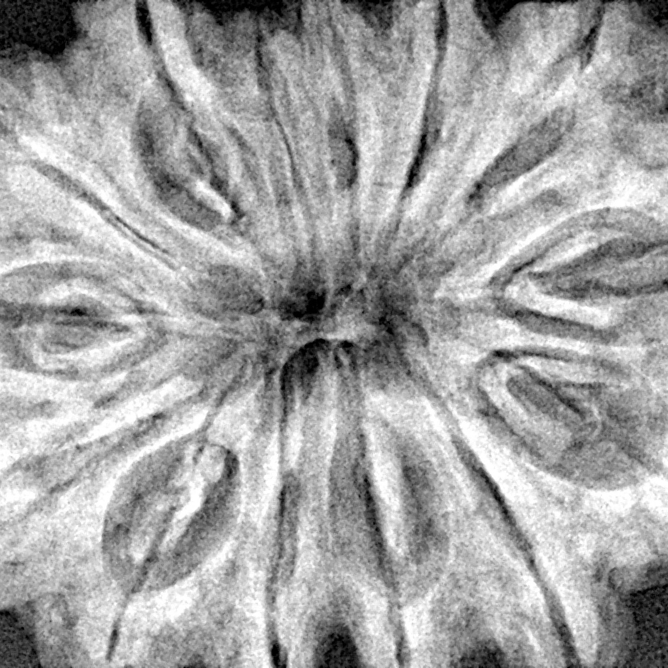 14 Mukhi Rudraksha 36.4mm 9.11gm - Xray