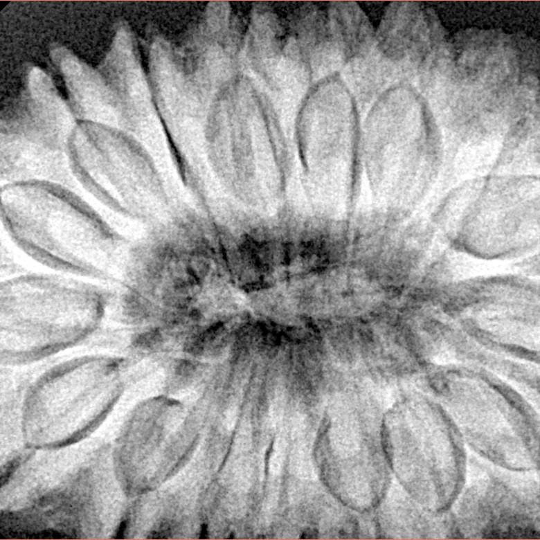 17 Mukhi Rudraksha 37.2mm 9.75gm - Xray