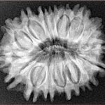 16 Mukhi Rudraksha 27.8mm 5gm - Xray