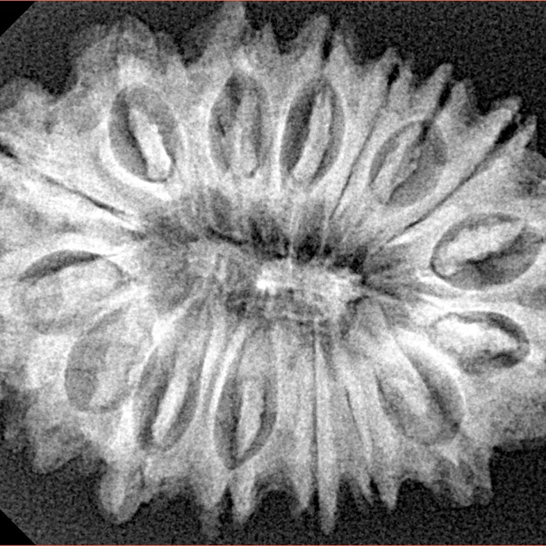 16 Mukhi Rudraksha 30.5mm 5.24gm - Xray