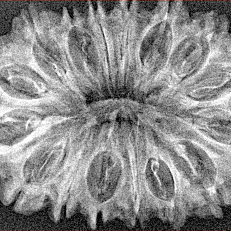 16 Mukhi Rudraksha 35.2mm 4.28gm - Xray