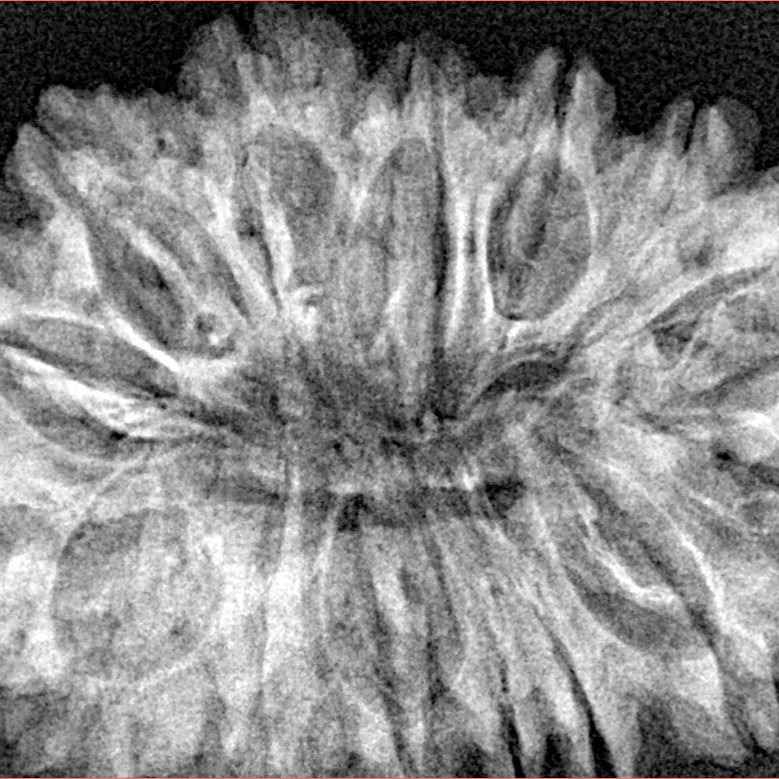16 Mukhi Rudraksha 35mm 5.75gm - Xray
